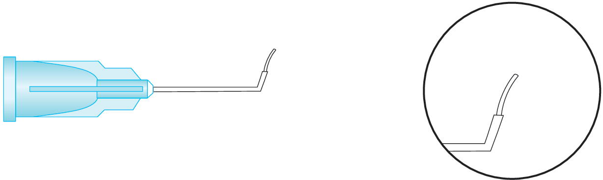 Viscocanalostomy Cannula